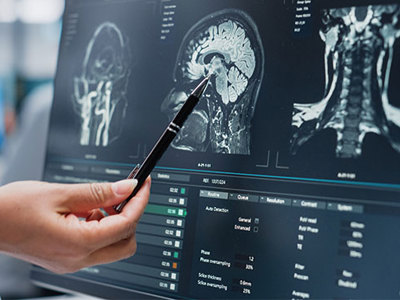 Photo of doctor pointing to brain scan report. 