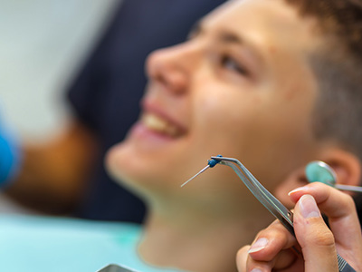 Close-up of a dental procedure with gloved hands holding dental instruments near a patient’s mouth, representing professional healthcare training and clinical practice.